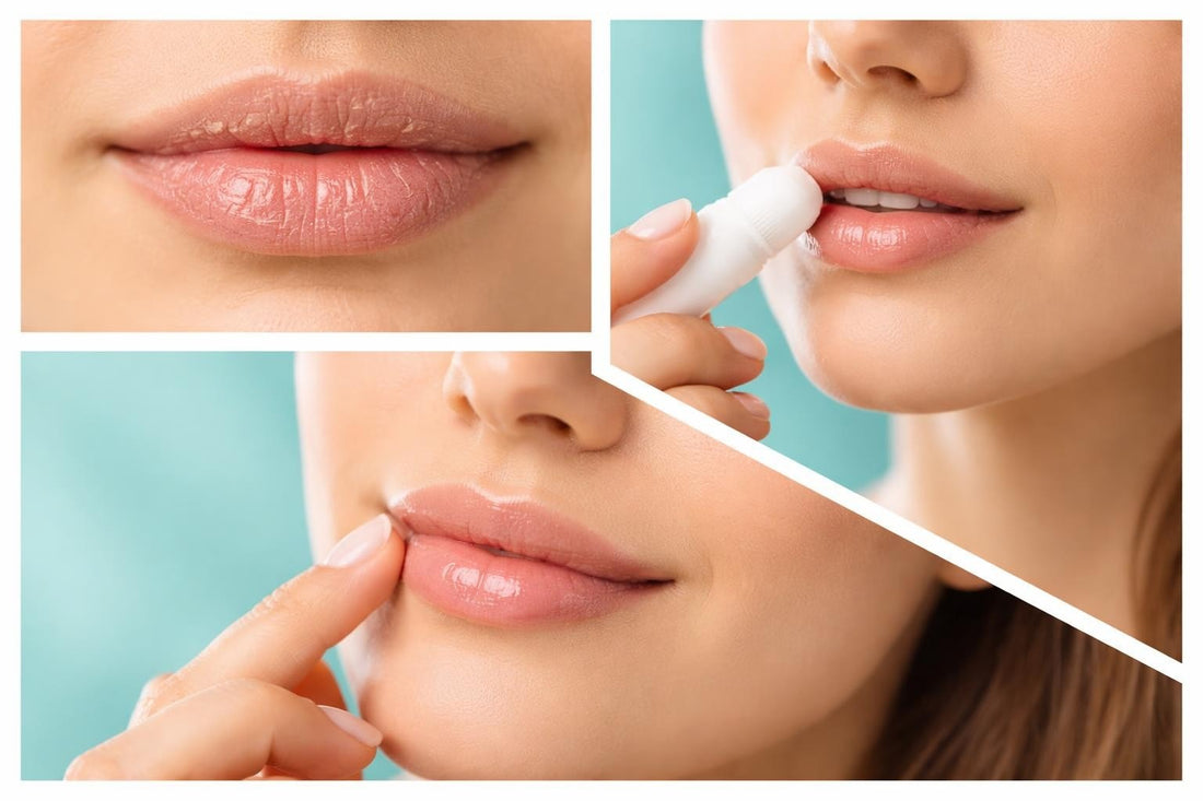 Lip Treat: Your 2026 Guide to Healthier, Softer Lips